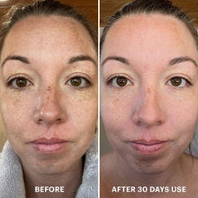 Load image into Gallery viewer, Bio-Renew EGF Cream